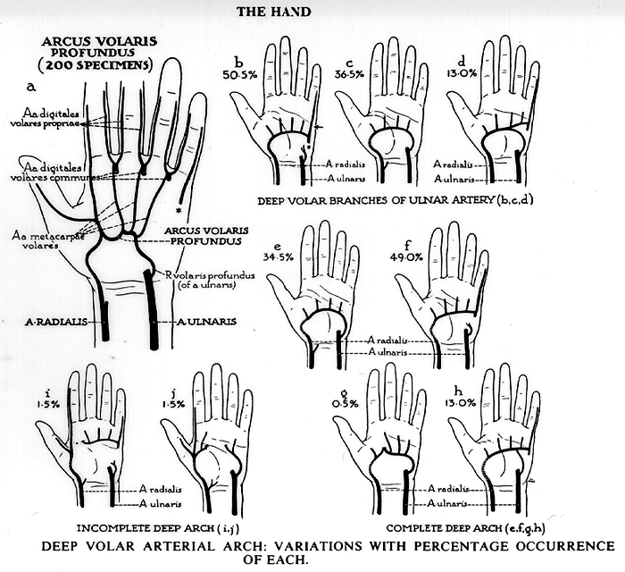 Image of deep palmar arch