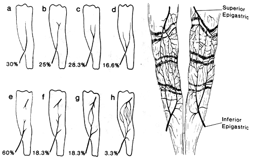 Image of superior and inferior epigastric arteries and rectus abdominis muscle