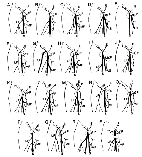 Image of venous drainage at fossa ovalis