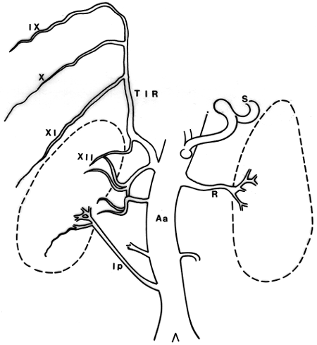 Image of truncus intercosto