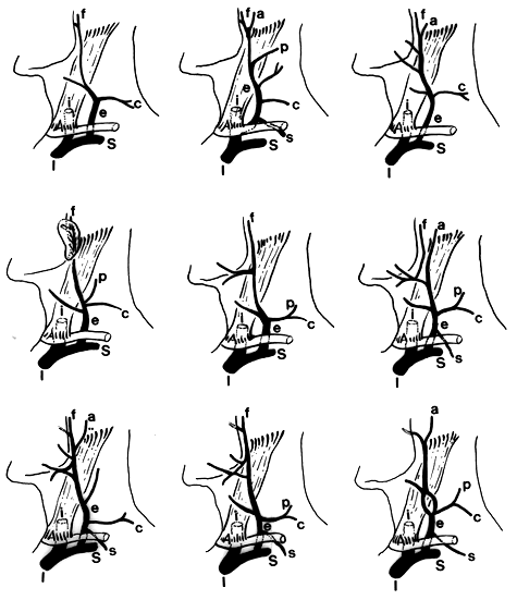 Image of external jugular vein