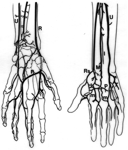 Image of palmar arch