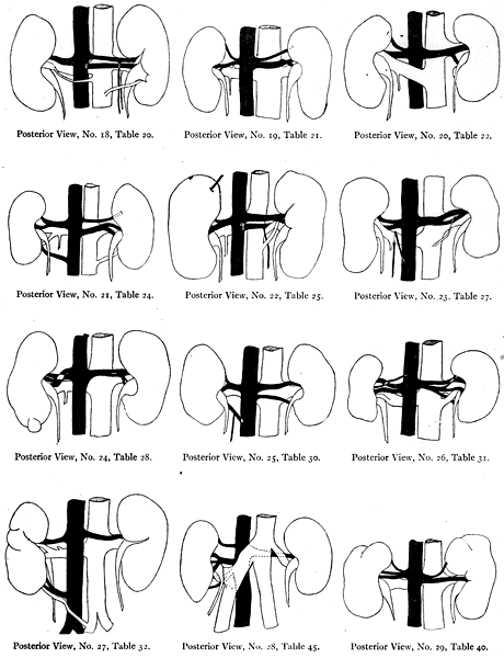 Image of irregular kidney vessels