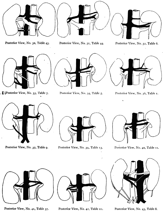 Image of irregular kidney vessels