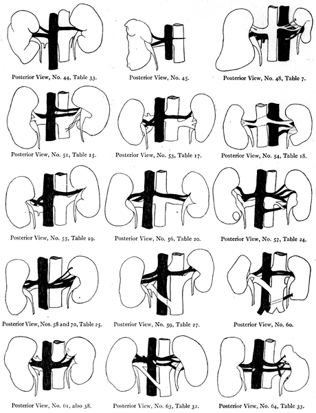 Image of irregular kidney vessels