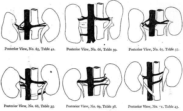 Image of irregular kidney vessels