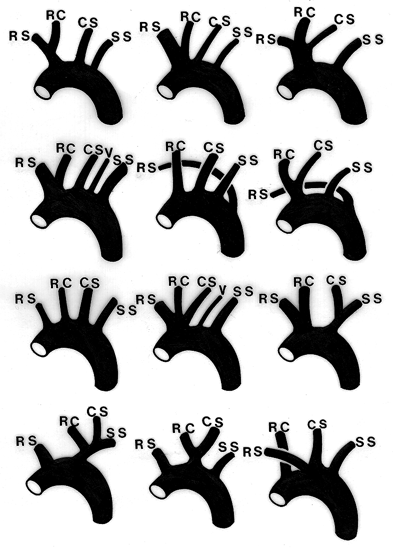 Image of branching order of aortic arch