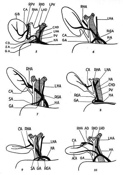 Image of hepatic pedicle