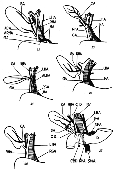 Image of hepatic pedicle