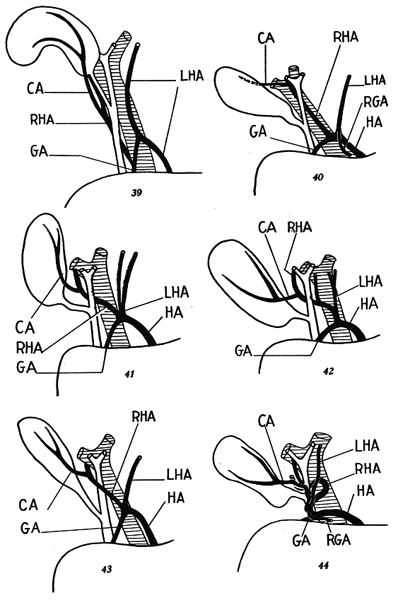 Image of hepatic pedicle