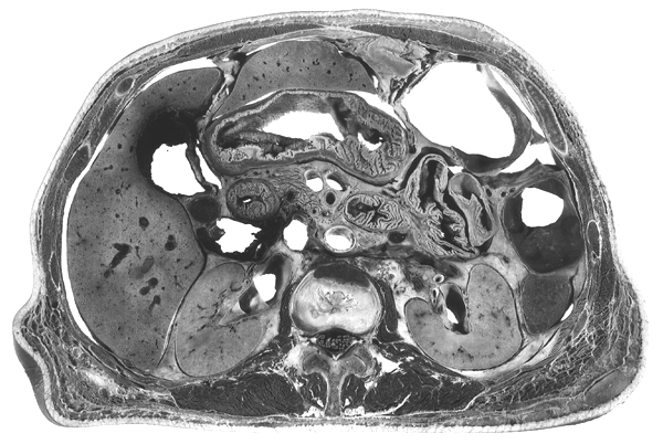 Image of vascular variations