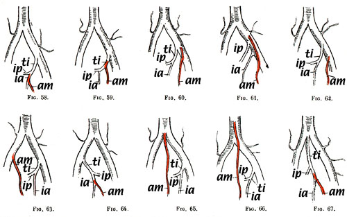 Image of variations in origin of median arteries