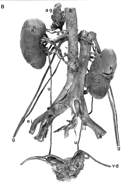 Image of multiple renal arteries