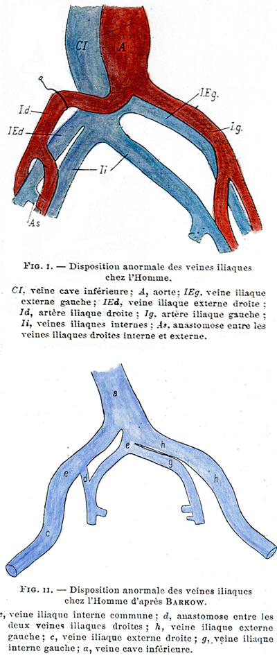 Iliac veins