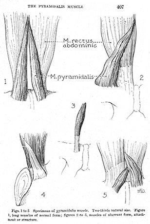 Image of varieties of pyramidalis