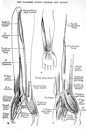 Image of varieties of palmaris longus