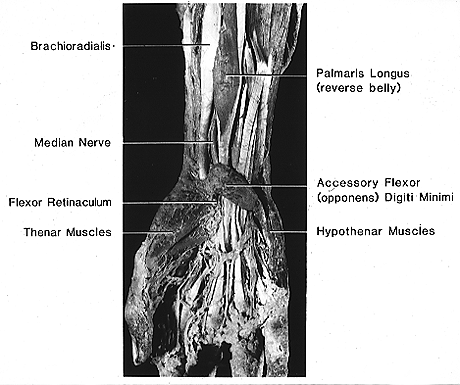 Image of accessory flexor