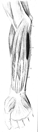 Image of doubled flexor carpi ulnaris