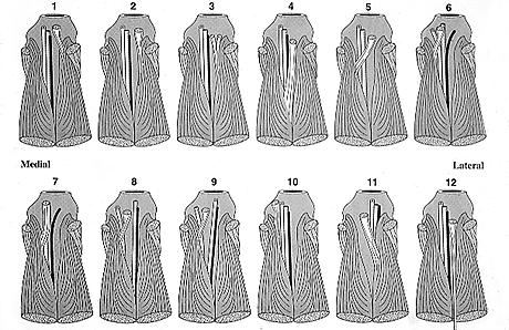 Image of twelve varieties of the third head of gastrocnemius