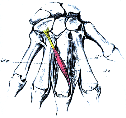 Image of unusual dorsal interosseous muscle