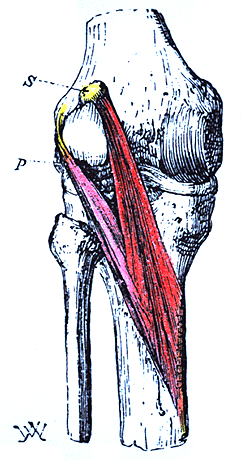 Image of doubled popliteus