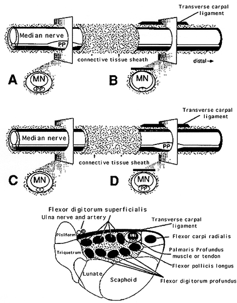 Image of musculus comitans nervi mediani s. palmaris profundus