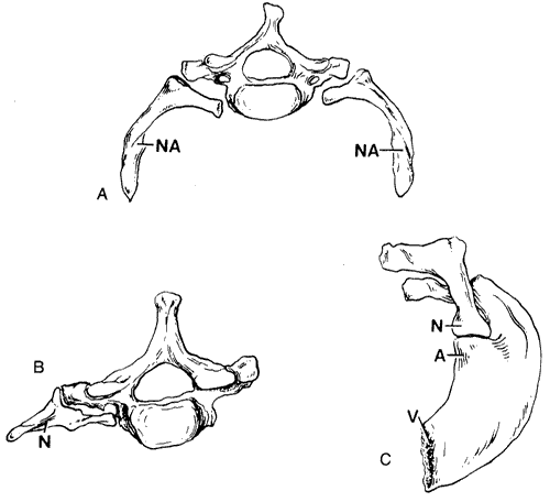 Cervical Rib