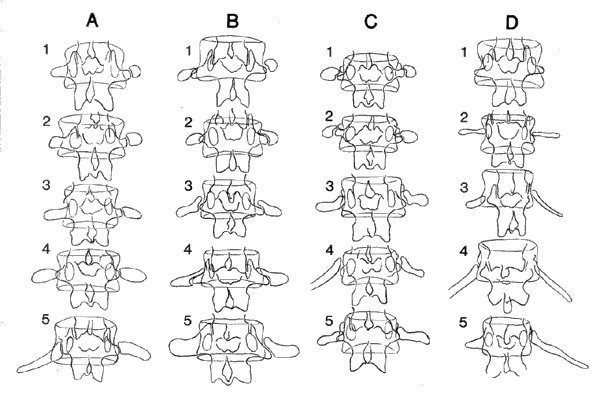 Variations in Lumbar Ribs