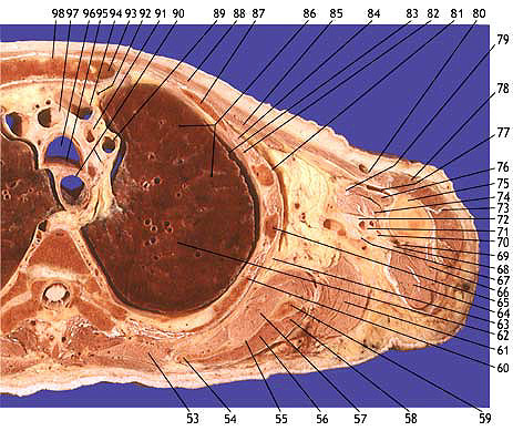 Plate 2.9b