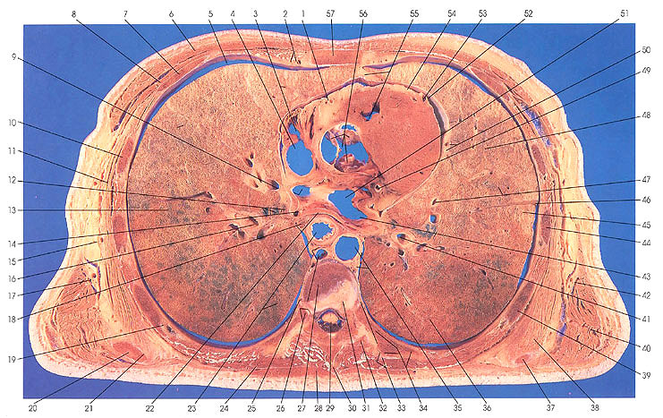 Plate 3.4