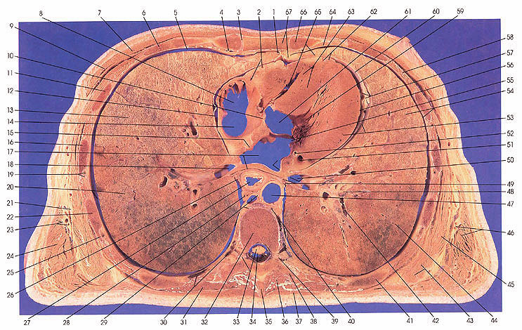 Plate 3.5