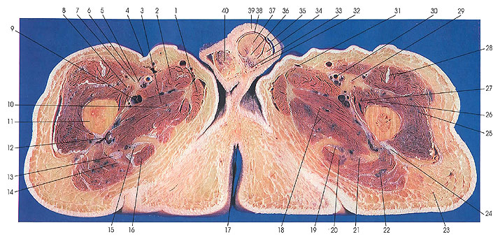 Plate 6.17