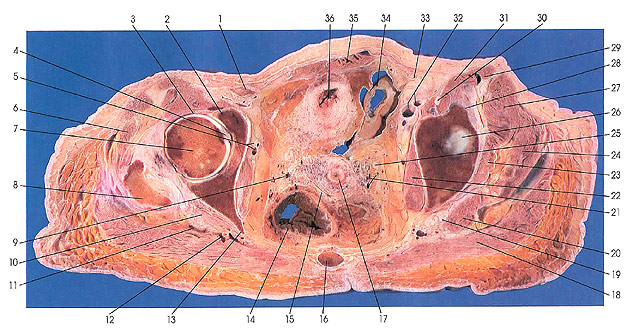 Plate 6.27