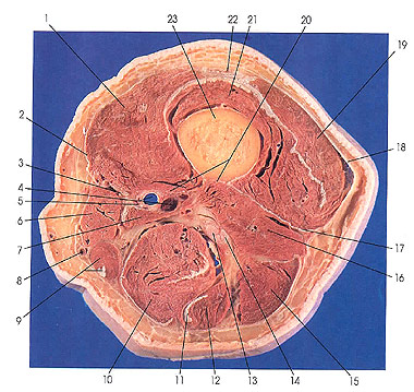 Plate 7.4