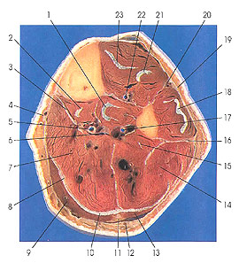 Plate 7.22