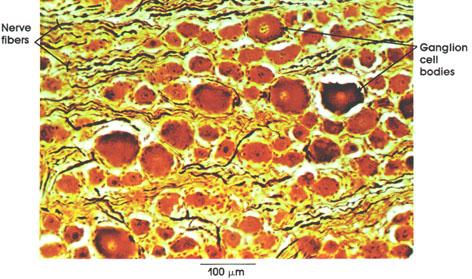 Plate 6.101 Dorsal Root Ganglion