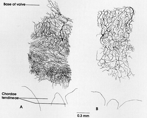 Plate 6.112 Mirtal Valve: Heart