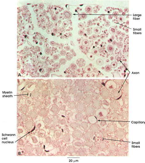 Plate 6.114 Spinal Root Nerve Fibers