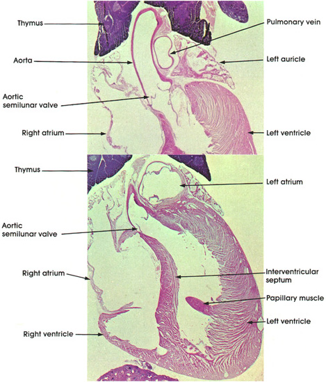 Plate 8.148 Heart Champers: Aorta