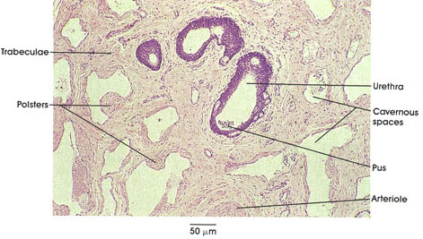 Plate 8.160 Cavernous Spaces, Erectile Tissue, Penis