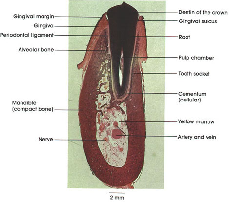 Plate 10.186 Tooth (In Situ)