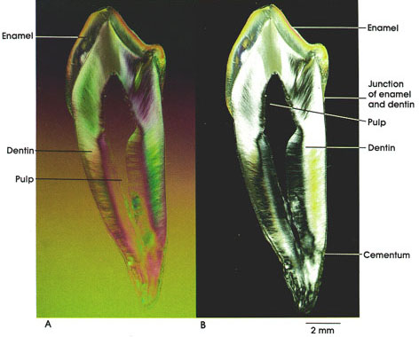 Plate 10.187 Ground Tooth