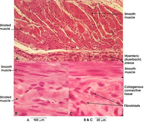 Plate 10.188 Esophagus