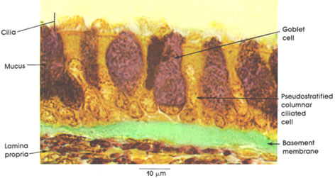 Plate 2.20: Basement Membrane