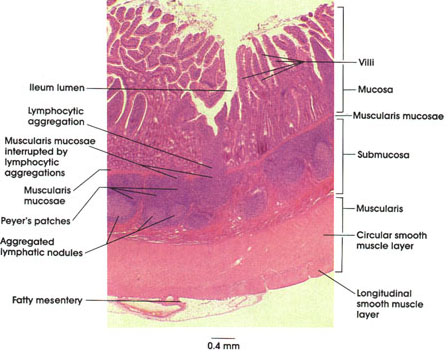 Plate 10.202 Ileum