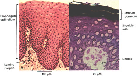 Plate 2.22: Stratified Squamous Epithelium