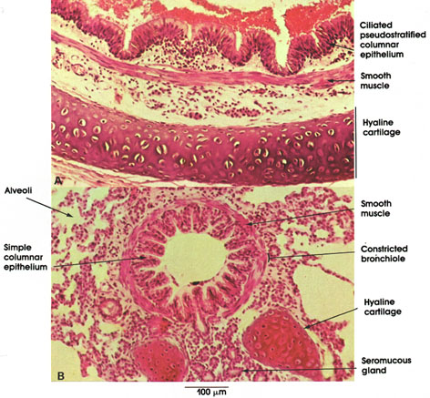 Plate 11.225 Bronchus and Bronchiole