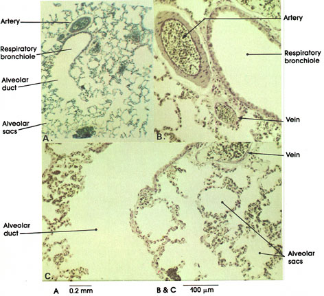 Plate 11.228 Respiratory Bronchiole, Duct, and Alveoli