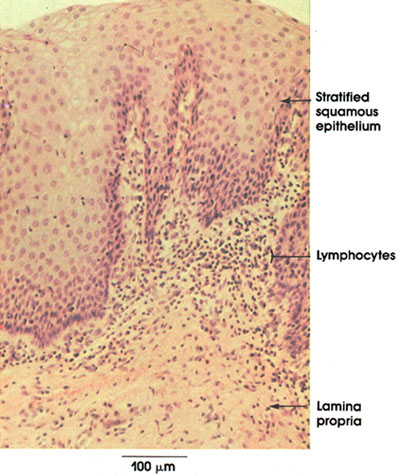 Plate 13.257 Vagina