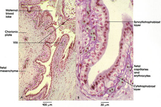 Plate 13.259 Placenta